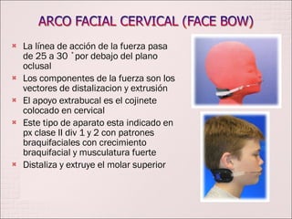 La línea de acción de la fuerza pasa de 25 a 30 ˚por debajo del plano oclusal Los componentes de la fuerza son los vectores de distalizacion y extrusión El apoyo extrabucal es el cojinete colocado en cervical Este tipo de aparato esta indicado en px clase II div 1 y 2 con patrones braquifaciales con crecimiento braquifacial y musculatura fuerte Distaliza y extruye el molar superior 