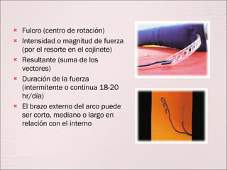 Fulcro (centro de rotación) Intensidad o magnitud de fuerza (por el resorte en el cojinete) Resultante (suma de los vectores) Duración de la fuerza (intermitente o continua 18-20 hr/día) El brazo externo del arco puede ser corto, mediano o largo en relación con el interno 