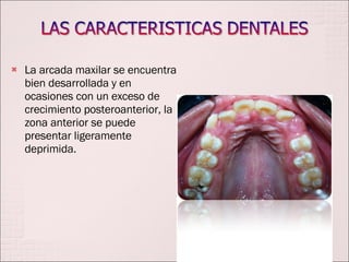La arcada maxilar se encuentra bien desarrollada y en ocasiones con un exceso de crecimiento posteroanterior, la zona anterior se puede presentar ligeramente deprimida. 