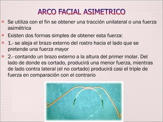 Se utiliza con el fin se obtener una tracción unilateral o una fuerza asimétrica Existen dos formas simples de obtener esta fuerza: 1.- se aleja el brazo externo del rostro hacia el lado que se pretende una fuerza mayor 2.- contando un brazo externo a la altura del primer molar. Del lado de donde es cortado, producirá una menor fuerza, mientras de lado contra lateral (el no cortado) producirá casi el triple de fuerza en comparación con el contrario 