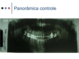 Panorâmica controle30.05.05