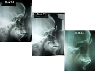 18.02.0326.02.0430.05.05