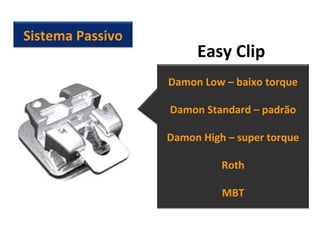Easy Clip
Sistema Passivo
Damon Low – baixo torque
Damon Standard – padrão
Damon High – super torque
Roth
MBT
 