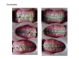Conclusões
 