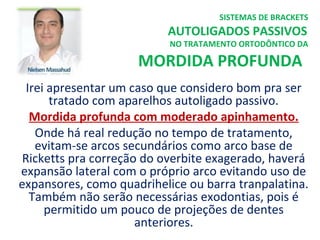 Irei apresentar um caso que considero bom pra ser
tratado com aparelhos autoligado passivo.
Mordida profunda com moderado apinhamento.
Onde há real redução no tempo de tratamento,
evitam-se arcos secundários como arco base de
Ricketts pra correção do overbite exagerado, haverá
expansão lateral com o próprio arco evitando uso de
expansores, como quadrihelice ou barra tranpalatina.
Também não serão necessárias exodontias, pois é
permitido um pouco de projeções de dentes
anteriores.
SISTEMAS DE BRACKETS
AUTOLIGADOS PASSIVOS
NO TRATAMENTO ORTODÔNTICO DA
MORDIDA PROFUNDA
 