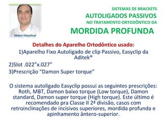 Detalhes do Aparelho Ortodôntico usado:
1)Aparelho Fixo Autoligado de clip Passivo, Easyclip da
Aditek®
2)Slot .022”x.027”
3)Prescrição “Damon Super torque”
O sistema autoligado Easyclip possui as seguintes prescrições:
Roth, MBT, Damon baixo torque (Low torque), Damon
standard, Damon super torque (High torque). Este último é
recomendado pra Classe II 2ª divisão, casos com
retroinclinações de incisivos superiores, mordida profunda e
apinhamento ântero-superior.
SISTEMAS DE BRACKETS
AUTOLIGADOS PASSIVOS
NO TRATAMENTO ORTODÔNTICO DA
MORDIDA PROFUNDA
 