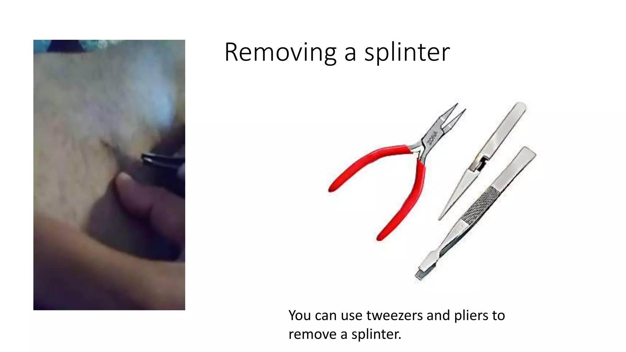 Removing a splinter
You can use tweezers and pliers to
remove a splinter.
 