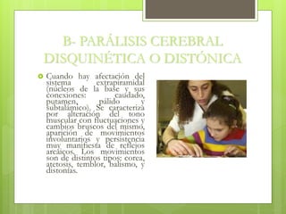 B- PARÁLISIS CEREBRAL
DISQUINÉTICA O DISTÓNICA
 Cuando hay afectación del
sistema extrapiramidal
(núcleos de la base y sus
conexiones: caudado,
putamen, pálido y
subtalámico). Se caracteriza
por alteración del tono
muscular con fluctuaciones y
cambios bruscos del mismo,
aparición de movimientos
involuntarios y persistencia
muy manifiesta de reflejos
arcaicos. Los movimientos
son de distintos tipos: corea,
atetosis, temblor, balismo, y
distonías.
 