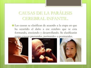 CAUSAS DE LA PARÁLISIS
CEREBRAL INFANTIL.
 Las causas se clasifican de acuerdo a la etapa en que
ha ocurrido el daño a ese cerebro que se esta
formando, creciendo y desarrollando. Se clasificarán
como causas prenatales, perinatales o postnatales.
 