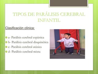 TIPOS DE PARÁLISIS CEREBRAL
INFANTIL
Clasificación clínica:
 a- Parálisis cerebral espástica
 b- Parálisis cerebral disquinética
 c- Parálisis cerebral atáxica
 d- Parálisis cerebral mixta
 