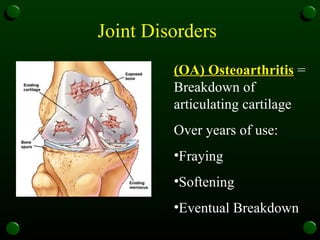 Joint Disorders  (OA) Osteoarthritis  = Breakdown of articulating cartilage Over years of use: Fraying  Softening  Eventual Breakdown  