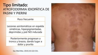 Tipo limitado:
ATROFODERMIA IDIOPÁTICA DE
PASINI Y PIERINI
Poco frecuente
Lesiones asintomáticas en espalda
simétricas, hiperpigmentadas,
deprimidas y piel NO indurada
Posteriormente progresan a
tronco y brazos, dando lugar a
dolor y prurito
Gac Med Mex. 2019;155:522-531.
 
