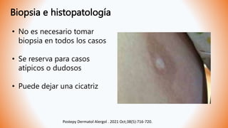Biopsia e histopatología
• No es necesario tomar
biopsia en todos los casos
• Se reserva para casos
atípicos o dudosos
• Puede dejar una cicatriz
Postepy Dermatol Alergol . 2021 Oct;38(5):716-720.
 