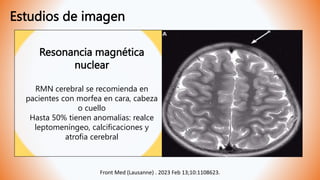 Estudios de imagen
Front Med (Lausanne) . 2023 Feb 13;10:1108623.
Resonancia magnética
nuclear
RMN cerebral se recomienda en
pacientes con morfea en cara, cabeza
o cuello
Hasta 50% tienen anomalías: realce
leptomeníngeo, calcificaciones y
atrofia cerebral
 