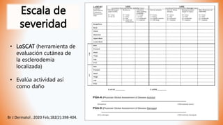 Escala de
severidad
• LoSCAT (herramienta de
evaluación cutánea de
la esclerodemia
localizada)
• Evalúa actividad así
como daño
Br J Dermatol . 2020 Feb;182(2):398-404.
 