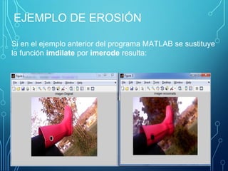 EJEMPLO DE EROSIÓN
Si en el ejemplo anterior del programa MATLAB se sustituye
la función imdilate por imerode resulta:
 