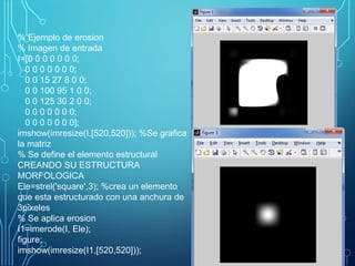 % Ejemplo de erosion
% Imagen de entrada
I=[0 0 0 0 0 0 0;
0 0 0 0 0 0 0;
0 0 15 27 8 0 0;
0 0 100 95 1 0 0;
0 0 125 30 2 0 0;
0 0 0 0 0 0 0;
0 0 0 0 0 0 0];
imshow(imresize(I,[520,520])); %Se grafica
la matriz
% Se define el elemento estructural
CREANDO SU ESTRUCTURA
MORFOLOGICA
Ele=strel('square',3); %crea un elemento
que esta estructurado con una anchura de
3pixeles
% Se aplica erosion
I1=imerode(I, Ele);
figure;
imshow(imresize(I1,[520,520]));
 