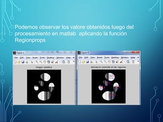 Podemos observar los valore obtenidos luego del
procesamiento en matlab aplicando la función
Regionprops
 
