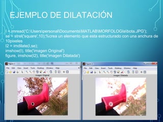 EJEMPLO DE DILATACIÓN
I = imread('C:UserspersonalDocumentsMATLABMORFOLOGIabota.JPG');
se = strel('square',10);%crea un elemento que esta estructurado con una anchura de
10pixeles
I2 = imdilate(I,se);
imshow(I), title('imagen Original')
figure, imshow(I2), title('imagen Dilatada')
 