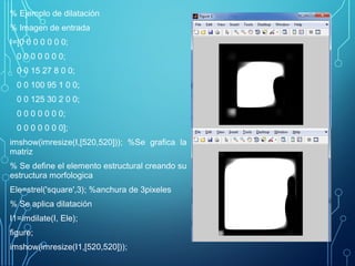 % Ejemplo de dilatación
% Imagen de entrada
I=[0 0 0 0 0 0 0;
0 0 0 0 0 0 0;
0 0 15 27 8 0 0;
0 0 100 95 1 0 0;
0 0 125 30 2 0 0;
0 0 0 0 0 0 0;
0 0 0 0 0 0 0];
imshow(imresize(I,[520,520])); %Se grafica la
matriz
% Se define el elemento estructural creando su
estructura morfologica
Ele=strel('square',3); %anchura de 3pixeles
% Se aplica dilatación
I1=imdilate(I, Ele);
figure;
imshow(imresize(I1,[520,520]));
 
