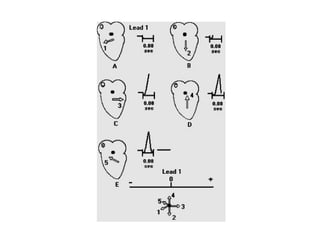 MORFOFISIOLOGIA CARDIACO.pdf