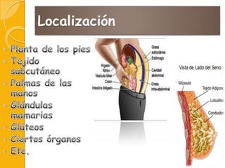 Localización

 