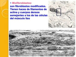 - Miofibroblastos:
son fibroblastos modificados.
Tienen haces de filamentos de
actina y cuerpos densos
semejantes a los de las células
del músculo liso

 