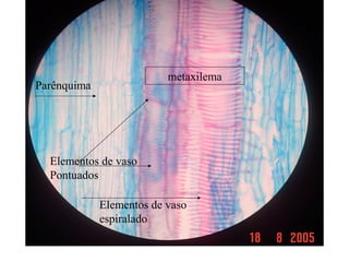 Elementos de vaso
Pontuados
Elementos de vaso
espiralado
metaxilema
Parênquima
 