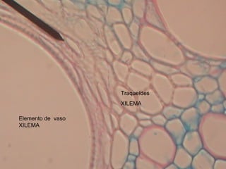 Elemento de vaso
XILEMA
Traqueídes
XILEMA
 