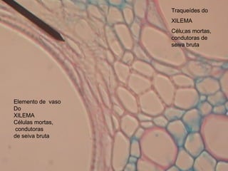 Traqueídes do
                   XILEMA
                   Célu;as mortas,
                   condutoras de
                   seiva bruta




Elemento de vaso
Do
XILEMA
Células mortas,
condutoras
de seiva bruta
 