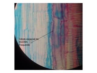 Célula especial do
XILEMA
Traqueíde
 