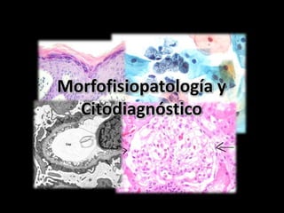 Morfofisiopatología y
Citodiagnóstico
 