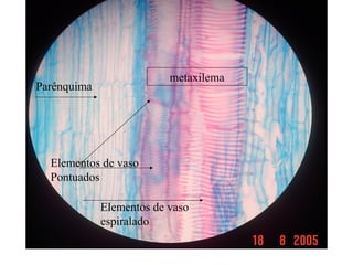 Elementos de vaso
Pontuados
Elementos de vaso
espiralado
metaxilema
Parênquima
 
