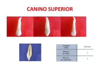 CANINO SUPERIOR   