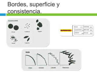 Bordes, superficie y 
consistencia. 
 