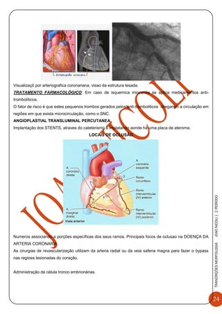 24
TRANCRIÇÕESMORFOLOGIAJOAONICOLI|2PERÌODO
Visualizaçõ por arteriografica coronariana, visao da estrutura lesada.
TRATAMENTO FARMACOLÓGICO: Em caso de isquemica miocardia se aplica medicamentos anti-
trombolíticos.
O fator de risco é que estes pequenos trombos gerados pelos anti-tromboliticos chegarem a circulação em
regiões em que exista microcirculação, como o SNC.
ANGIOPLASTIAL TRANSLUMINAL PERCUTANEA
Implantação dos STENTS, atraves do cateterismo é implatando aonde há uma placa de ateroma.
LOCAIS DE OCLUSÃO
Numeros associando a porções específicas dos seus ramos. Principais focos de oclusao na DOENÇA DA
ARTERIA CORONARIA.
As cirurgias de revascularização utilizam da arteria radial ou da veia safena magna para fazer o bypass
nas regioes lesionadas do coração.
Administração de célula tronco embrionárias.
 