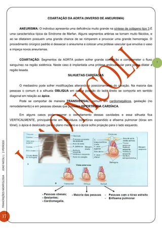 37
TRANCRIÇÕESMORFOLOGIAJOAONICOLI|2PERÌODO
1
COARTAÇÃO DA AORTA (INVERSO DE ANEURISMA)
ANEURISMA: O individuo apresenta uma deficiência muito grande na síntese de colágeno tipo 3.É
uma característica típica da Síndrome de Marfan. Alguns segmentos artérias se tornam muito flácidos, e
ao se dilatarem possuem uma grande chance de se romperem e provocar uma grande hemorragia. O
procedimento cirúrgico padrão é dessecar o aneurisma e colocar uma prótese vascular que envolva o vaso
e impeça novos aneurismas.
COARTAÇÃO: Segmentos da AORTA podem sofrer grande constrição e comprometer o fluxo
sanguíneo na região sistêmica. Neste caso é implantada uma prótese endovascular para poder dilatar a
região lesada.
SILHUETAS CARDÍACAS
O mediastino pode sofrer modificações alterando o posicionamento do coração. Na maioria das
pessoas o comum é a silhueta OBLIQUA em que a posição do lado direito se comporta em sentido
diagonal em relação ao ápice.
Pode se comportar de maneira TRANSVERSAL, comum em cardiomegálicos, gestação (no
remodelamento) e em pessoas obesas que possuem HIPERTROFIA CARDÍACA.
Em alguns casos pode ocorrer o estreitamento dessas cavidades e essa silhueta fica
VERTICALMENTE, principalmente em indivíduos com tórax expandido e efisema pulmonar (tórax em
tónel), o ápice é deslocado para o plano mediano e o ápice sofre projeção para o lado esquerdo.
 