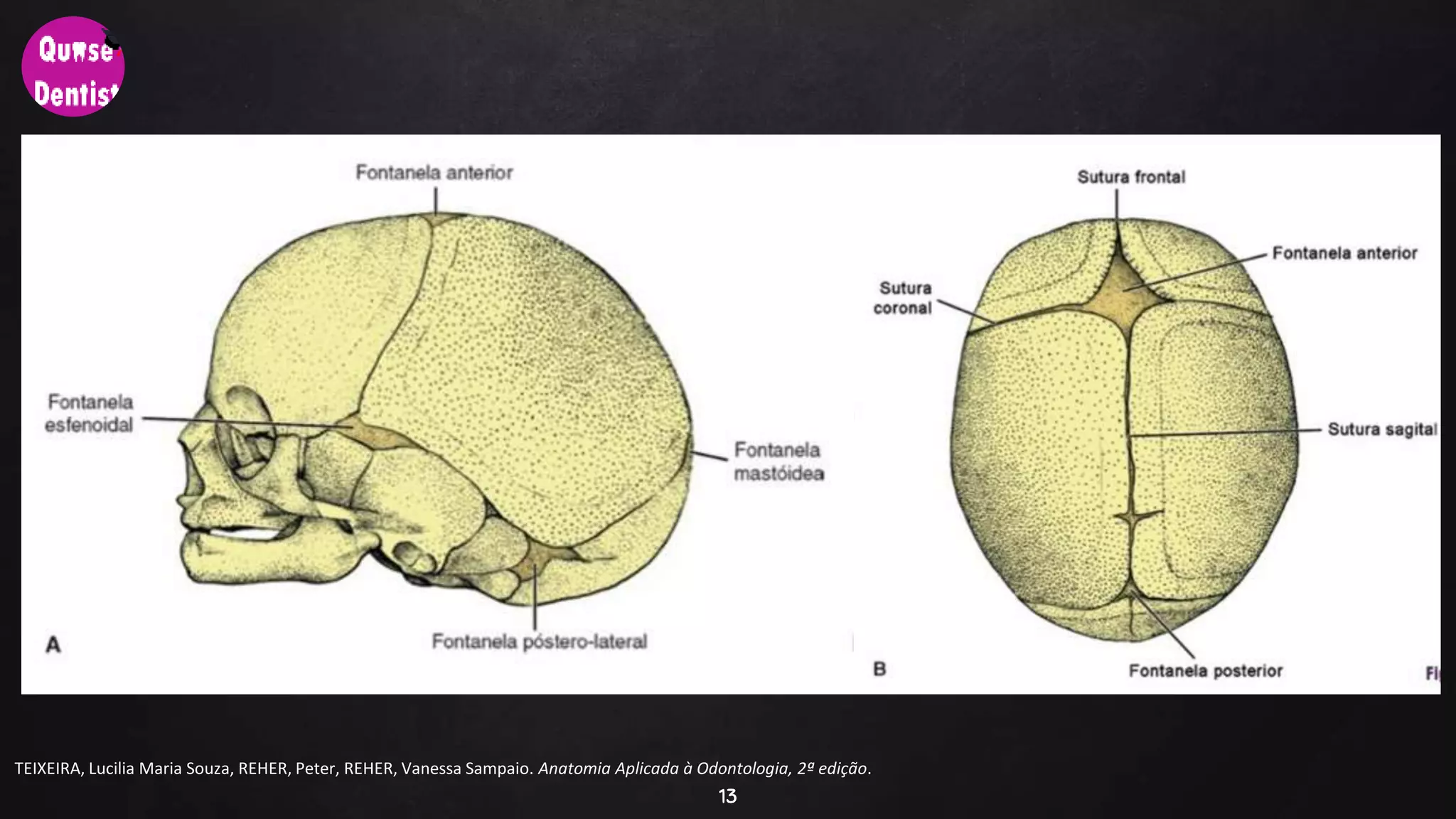 MORFOLOGIA CABEÇA E PESCOÇO-OSTEOLOGIA | PPTX