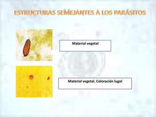 Material vegetal
Material vegetal. Coloración lugol
 