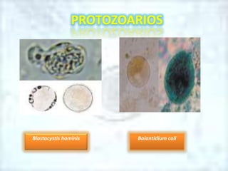 Blastocystis hominis Balantidium coli
PROTOZOARIOS
 