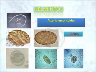 Áscaris lumbricoides
HUEVOS
 