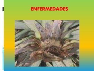 ENFERMEDADES
 