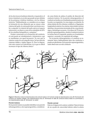 Tijerina de la Garza O y col.




de los dos troncos lumbares (derecho e izquierdo) y el            do como límite de ambas el cambio de dirección del
tronco intestinal, en un sitio que puede ser por delante          conducto torácico. En la porción infraacigoaórtica, el
de las primeras vértebras lumbares o de las últimas               conducto se localiza en el mediastino posterior junto con
torácicas.5 Habitualmente, se considera en su origen              la aorta a su izquierda y la vena ácigos a su derecha. Se
la formación de una dilatación que se conoce como                 sitúan detrás de él la columna vertebral y el ligamento
cisterna del quilo, la cual puede tener una forma sacu-           longitudinal anterior, las arterias intercostales aórticas
lar o ampular. La cisterna del quilo está en el espacio           derechas y las porciones terminales de las venas hemiá-
retrocrural y se observa como tal en alrededor de 20%             cigos y hemiácigos accesoria. A la altura de T5 inicia la
de los estudios linfográﬁcos y autopsias.9                        porción supraacigoaórtica, donde el conducto torácico
   Existen variaciones en la formación del conducto,              se inclina hacia la izquierda, penetra en el mediastino
el cual puede ser intrabdominal o intratorácico, que              superior y asciende a la izquierda del esófago.
se maniﬁestan con igual frecuencia.6 Es raro que la                  En la porción infraacigoaórtica, el conducto es ra-
cisterna conste de una ampolla única. Se han descrito             ramente único; habitualmente tiene dos conductos o
cisternas dobles y triples (ﬁgura 2). Pero la disposi-            puede ser plexiforme. En la porción supraacigoaórtica,
ción más común es la plexiforme, en la que es difícil             suele observarse un solo conducto.
reconocer el tipo de cisterna clásico.5



     A                                          B                                            C




             D                                                                    E




Figura 3. Diferentes modos de desembocadura del conducto torácico. A. Conducto simple de desembocadura única. B. Terminación del
conducto con cayados múltiples, pero desembocadura única. C. Terminación en delta. D. Conducto torácico doble en su terminación y
con desembocadura doble. E. Terminación “en araña”.

Porción torácica                                                  Porción cervical
En la porción torácica se pueden identiﬁcar una porción           Está en el trígono de la arteria vertebral. Tiene la forma
infraacigoaórtica y otra supraacigoaórtica, consideran-           de un cayado de concavidad inferior sobre la arteria


74                                                                                     Medicina Universitaria ISSN 1665-5796
 