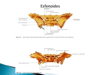 Esfenoides  