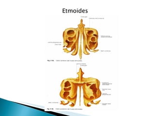 Etmoides  