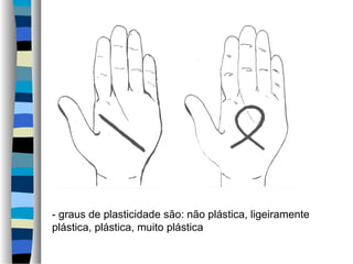 - graus de plasticidade são: não plástica, ligeiramente
plástica, plástica, muito plástica
 