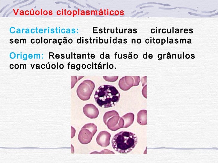 O Que Significa Ausencia De Granulacoes Toxicas Nos Neutrofilos