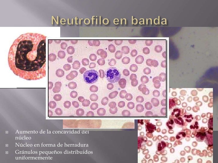 Morfologia leucos