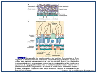 Técnicas de identificação bacterianas
 