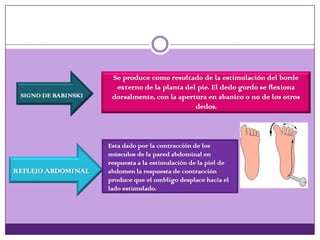 SIGNO DE BABINSKI
Se produce como resultado de la estimulación del borde
externo de la planta del pie. El dedo gordo se flexiona
dorsalmente, con la apertura en abanico o no de los otros
dedos.
REFLEJO ABDOMINAL
Esta dado por la contracción de los
músculos de la pared abdominal en
respuesta a la estimulación de la piel de
abdomen la respuesta de contracción
produce que el ombligo desplace hacia el
lado estimulado.
 